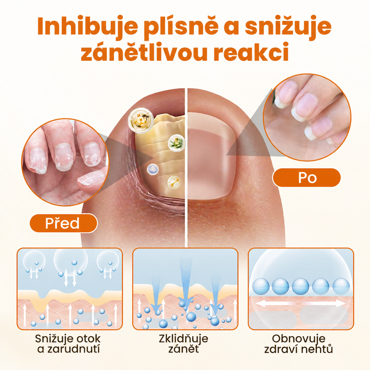 Timilk® FungiBee Advanced – Regenerační sprej pro oslabené nehty🎁