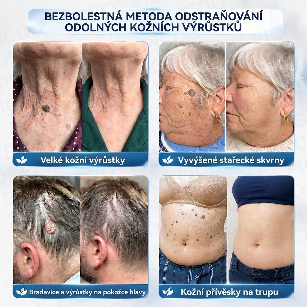 APKAPK® 𝟕𝐝𝐞𝐧𝐧í 𝐤𝐫é𝐦 𝐩𝐫𝐨𝐭𝐢 𝐤𝐨ž𝐧í𝐦 𝐯𝐲𝐫ů𝐬𝐭𝐤ů𝐦 𝐚 𝐩𝐢𝐠𝐦𝐞𝐧𝐭𝐨𝐯ý𝐦 𝐬𝐤𝐯𝐫𝐧á𝐦 (𝐁𝐞𝐳𝐛𝐨𝐥𝐞𝐬𝐭𝐧á 𝐟𝐨𝐫𝐦𝐮𝐥𝐞 – 𝐛𝐞𝐳 𝐣𝐢𝐳𝐞𝐯)⭐️