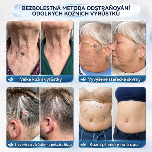 APKAPK® 𝟕𝐝𝐞𝐧𝐧í 𝐤𝐫é𝐦 𝐩𝐫𝐨𝐭𝐢 𝐤𝐨ž𝐧í𝐦 𝐯𝐲𝐫ů𝐬𝐭𝐤ů𝐦 𝐚 𝐩𝐢𝐠𝐦𝐞𝐧𝐭𝐨𝐯ý𝐦 𝐬𝐤𝐯𝐫𝐧á𝐦 (𝐁𝐞𝐳𝐛𝐨𝐥𝐞𝐬𝐭𝐧á 𝐟𝐨𝐫𝐦𝐮𝐥𝐞 – 𝐛𝐞𝐳 𝐣𝐢𝐳𝐞𝐯)⭐️