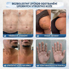 APKAPK® 𝟕𝐝𝐞𝐧𝐧í 𝐤𝐫é𝐦 𝐩𝐫𝐨𝐭𝐢 𝐤𝐨ž𝐧í𝐦 𝐯𝐲𝐫ů𝐬𝐭𝐤ů𝐦 𝐚 𝐩𝐢𝐠𝐦𝐞𝐧𝐭𝐨𝐯ý𝐦 𝐬𝐤𝐯𝐫𝐧á𝐦 (𝐁𝐞𝐳𝐛𝐨𝐥𝐞𝐬𝐭𝐧á 𝐟𝐨𝐫𝐦𝐮𝐥𝐞 – 𝐛𝐞𝐳 𝐣𝐢𝐳𝐞𝐯)⭐️