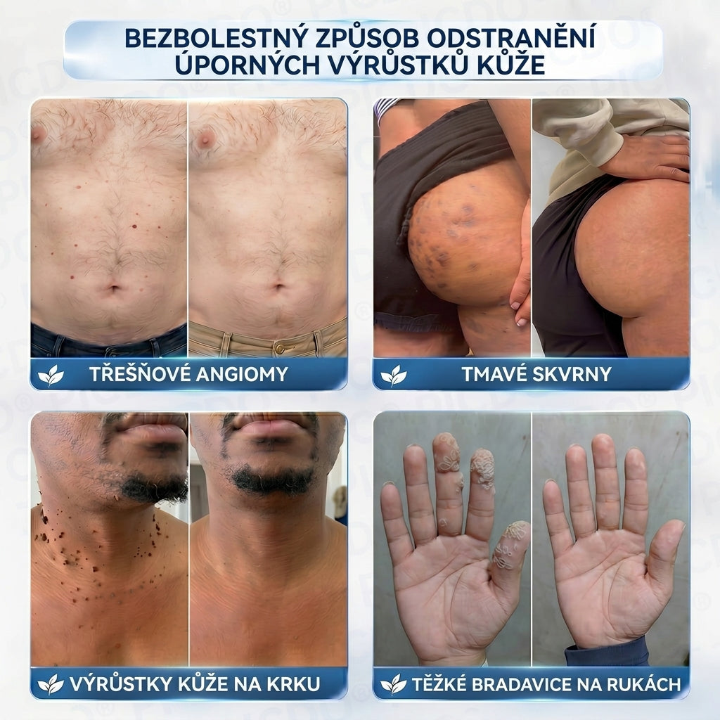 APKAPK® 𝟕𝐝𝐞𝐧𝐧í 𝐤𝐫é𝐦 𝐩𝐫𝐨𝐭𝐢 𝐤𝐨ž𝐧í𝐦 𝐯𝐲𝐫ů𝐬𝐭𝐤ů𝐦 𝐚 𝐩𝐢𝐠𝐦𝐞𝐧𝐭𝐨𝐯ý𝐦 𝐬𝐤𝐯𝐫𝐧á𝐦 (𝐁𝐞𝐳𝐛𝐨𝐥𝐞𝐬𝐭𝐧á 𝐟𝐨𝐫𝐦𝐮𝐥𝐞 – 𝐛𝐞𝐳 𝐣𝐢𝐳𝐞𝐯)⭐️