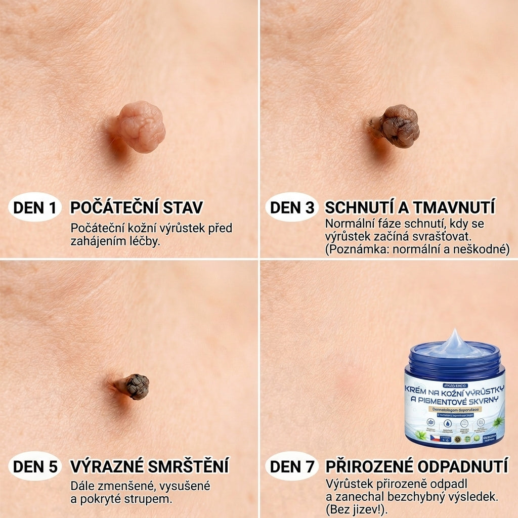 APKAPK® 𝟕𝐝𝐞𝐧𝐧í 𝐤𝐫é𝐦 𝐩𝐫𝐨𝐭𝐢 𝐤𝐨ž𝐧í𝐦 𝐯𝐲𝐫ů𝐬𝐭𝐤ů𝐦 𝐚 𝐩𝐢𝐠𝐦𝐞𝐧𝐭𝐨𝐯ý𝐦 𝐬𝐤𝐯𝐫𝐧á𝐦 (𝐁𝐞𝐳𝐛𝐨𝐥𝐞𝐬𝐭𝐧á 𝐟𝐨𝐫𝐦𝐮𝐥𝐞 – 𝐛𝐞𝐳 𝐣𝐢𝐳𝐞𝐯)⭐️
