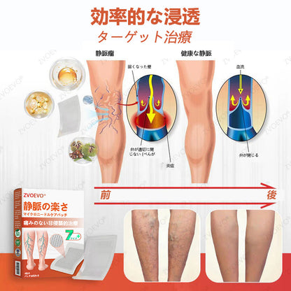☘️【厚生労働省認可・GMP準拠】Zvoevo® Vein Ease マイクロニードルケアパッチ（クモ状静脈・静脈瘤・むくみ・脚の疲れに）⭐️