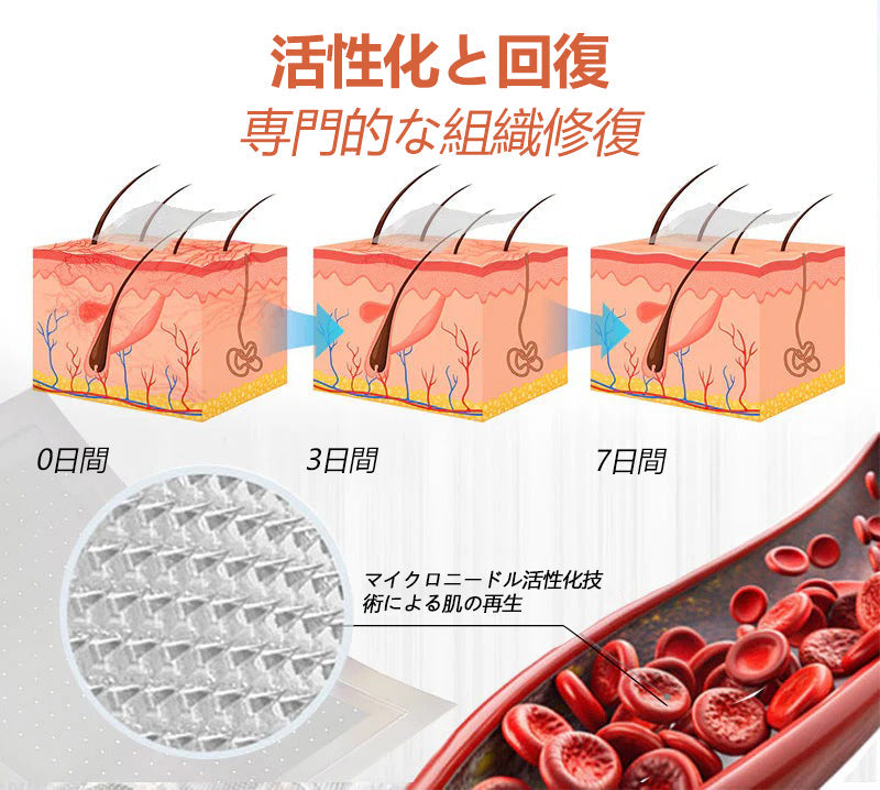 ☘️【厚生労働省認可・GMP準拠】Zvoevo® Vein Ease マイクロニードルケアパッチ（クモ状静脈・静脈瘤・むくみ・脚の疲れに）⭐️