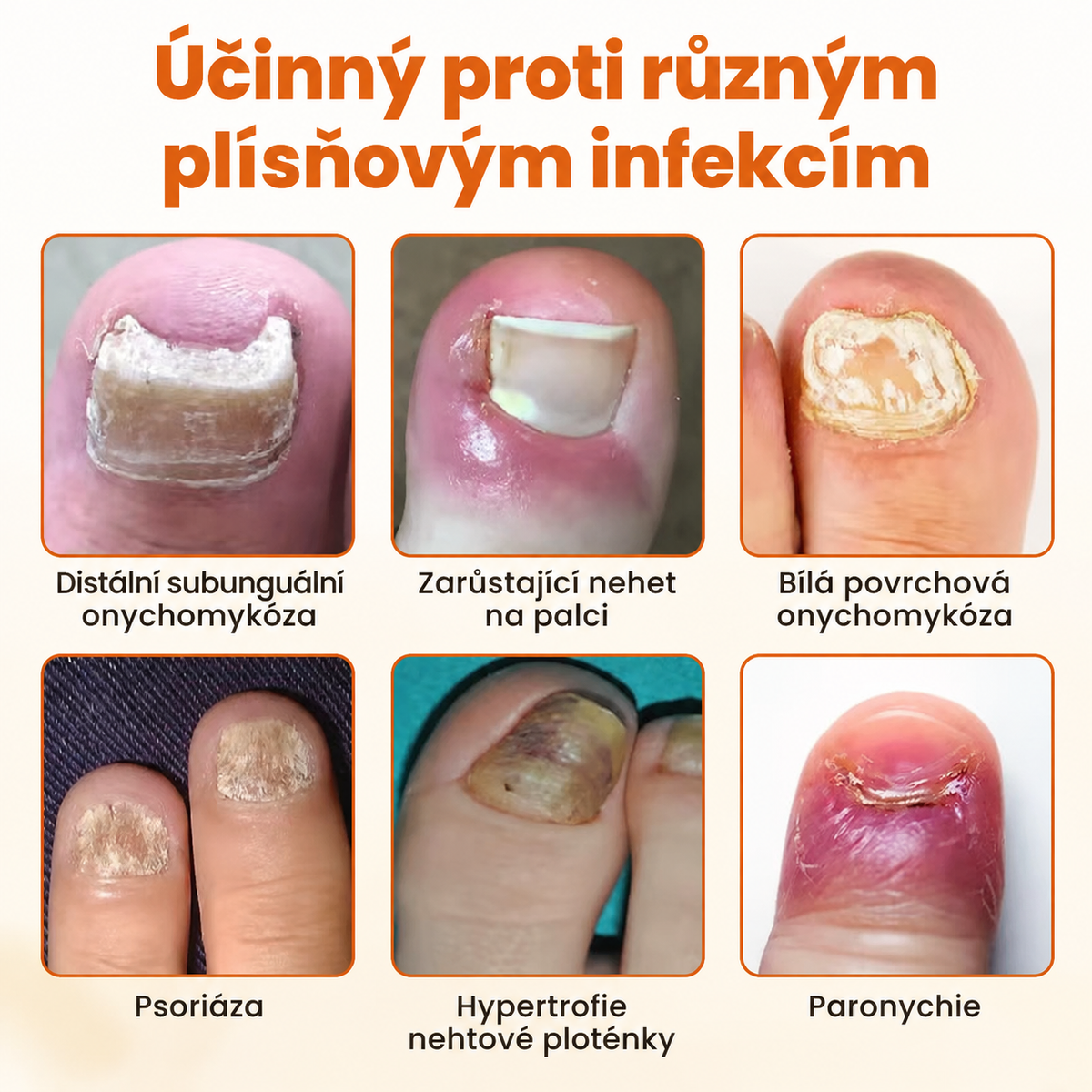 Timilk® FungiBee Advanced – Regenerační sprej pro oslabené nehty🎁