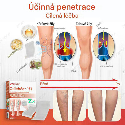 ☘️ Zvoevo® Vein Ease mikrojehličkové náplasti (pro zlepšení stavu pavoučích žil, křečových žil a otoků a únavy nohou)