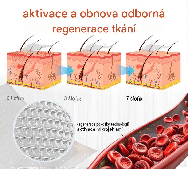 ☘️ Zvoevo® Vein Ease mikrojehličkové náplasti (pro zlepšení stavu pavoučích žil, křečových žil a otoků a únavy nohou)