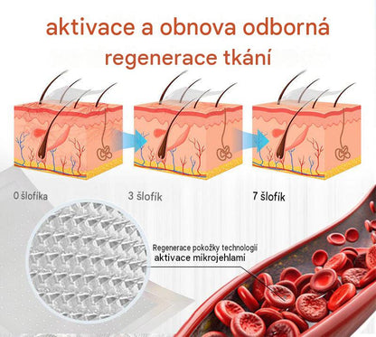 ☘️ Zvoevo® Vein Ease mikrojehličkové náplasti (pro zlepšení stavu pavoučích žil, křečových žil a otoků a únavy nohou)